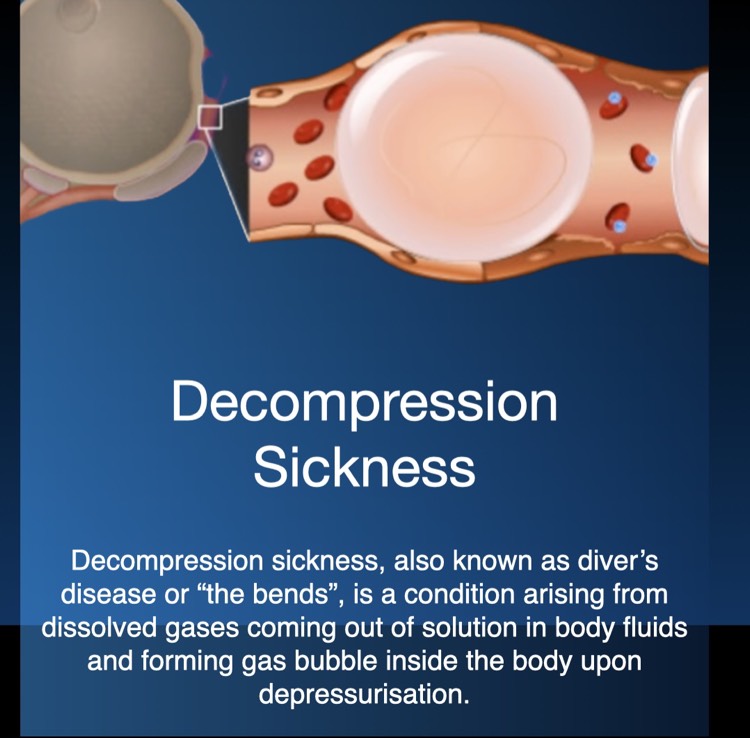 Decompression Sickness