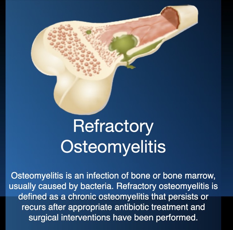 Refractory Osteomyelitis